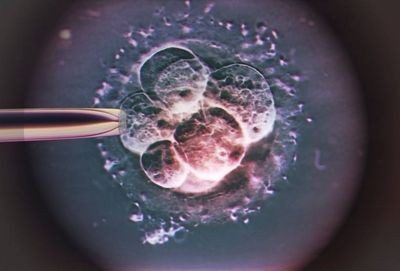 В британии созданы человеческие эмбрионы от трёх родителей